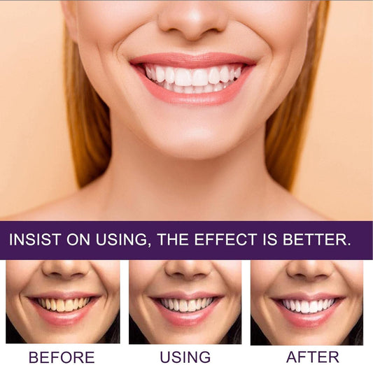 مبيض الأسنان السحري